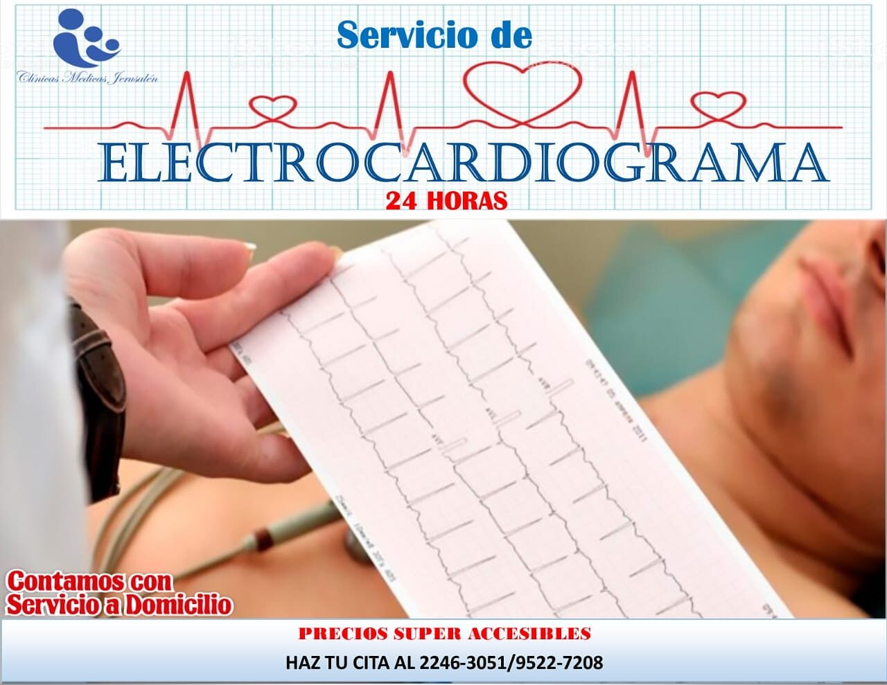 Electrocardiograma